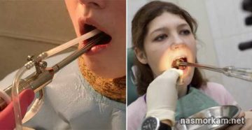 37 недель беременности и вытекает жидкий гной из миндалин 37 недель беременности и вытекает жидкий гной из миндалин