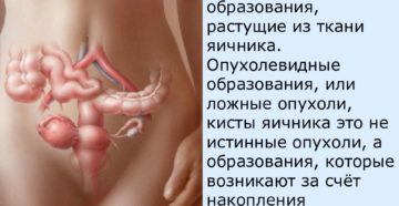 Боль при надавливании в область правого яичника Боль при надавливании в область правого яичника