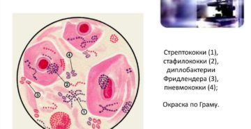 Стафилококк в мокроте