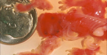 Медикаментозное прерывание из-за замершей беременности