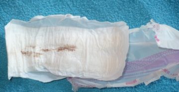 Кровавые выделения на трусах Кровавые выделения на трусах