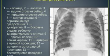 Расшифровка рентгена легких онлайн