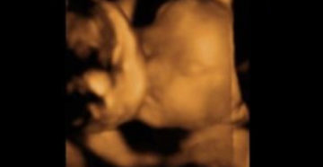 Берем.28 недель, слабые и редкие шевеления