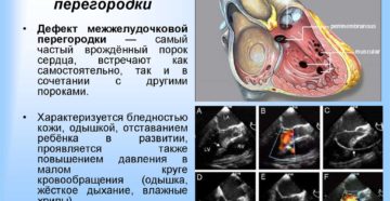 ВПС. ДМЖП. НК 1 ст. Возможно самостоятельное закрытие?