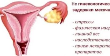 Задержка месячных после наркоза