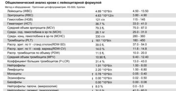 ОАК: повышенное СОЭ 25