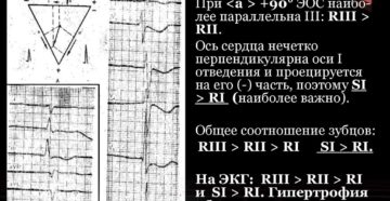 Отклонение ЭОС вправо