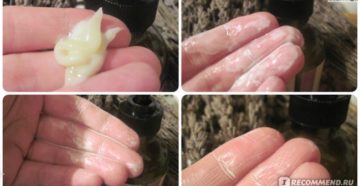 Белый налёт на клиторе