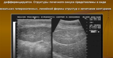 Чем опасна повышенная эхогенность обеих почек плода?