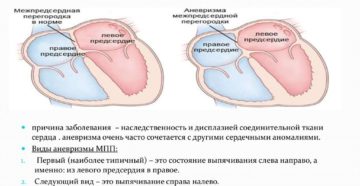 Истончена мпп в с/3