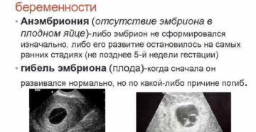 Анэмбриония: делать чистку или нет?