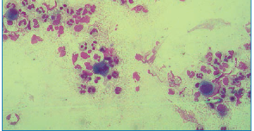 Макрофаги в мазке