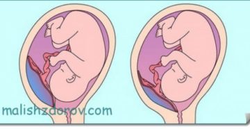 Беременность 19 недель плацентация Беременность 19 недель плацентация