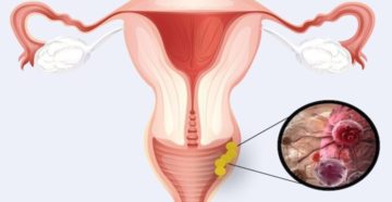 Отек влагалища