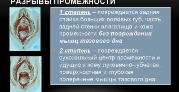 Разрыв большой половой губы после секса