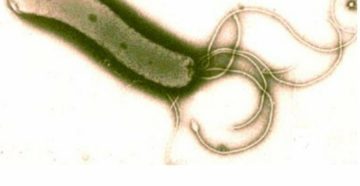 Беременность и хеликобактер