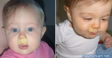 Зеленые сопли три месяца, не проходят Зеленые сопли три месяца, не проходят