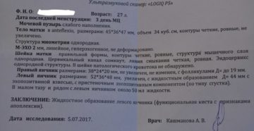 Здесь есть результат гистологии кисты яичника?