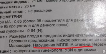 Нарушение мппк 1а степени