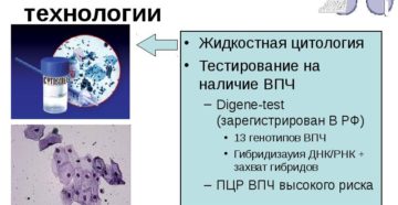 Жидкостная цитология и впч 16 Жидкостная цитология и впч 16
