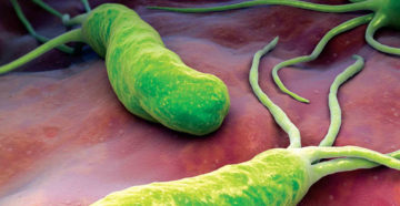 Бактерия Хеликобактер