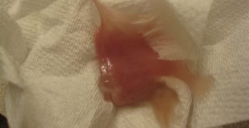 Выделения во время беременности Выделения во время беременности