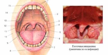 Дырка в нёбной дужке Дырка в нёбной дужке