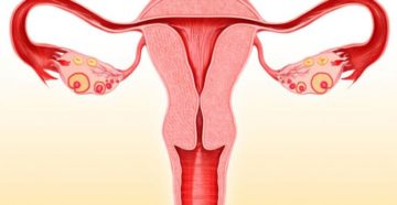 Толстый эндометрий