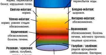Моча серого цвета