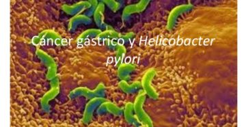 Крапивница от хеликобактер пилори. Такое может быть?