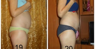 Растет живот, беременности нет, месячных тоже Растет живот, беременности нет, месячных тоже